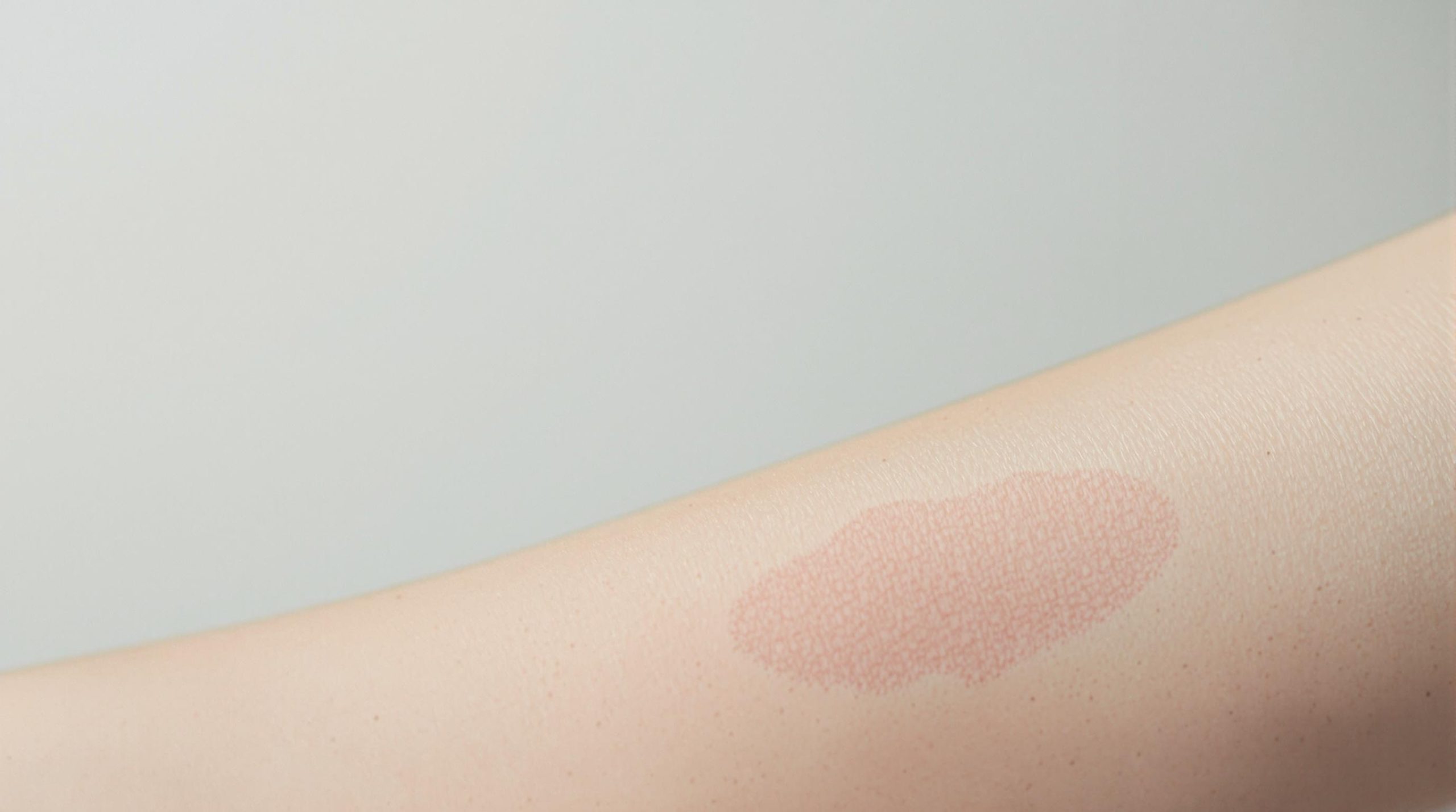 Cicatrice rouge : que faire ? - Beaute Lumiere