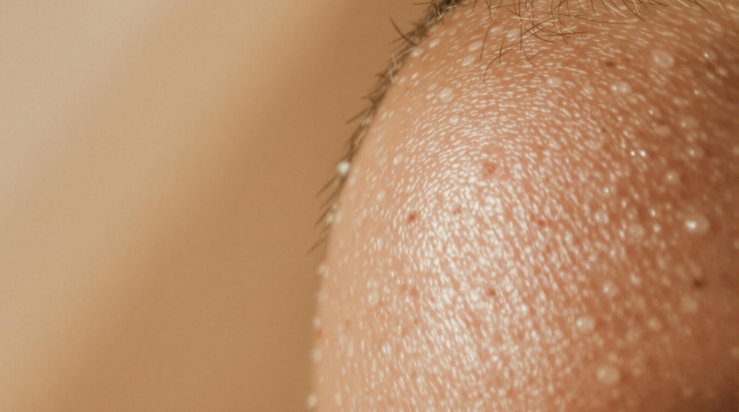 Cuir chevelu qui gratte et pellicules : comprendre et traiter - Beaute Lumiere